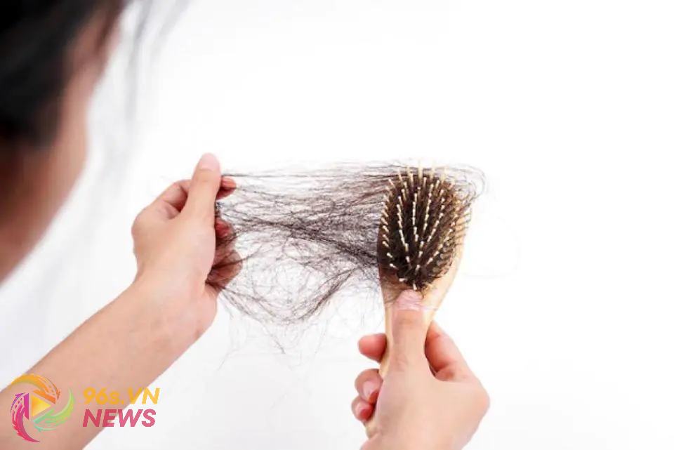 Rụng tóc nhiều là gì?