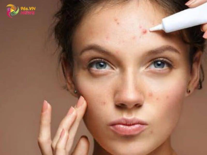 Bước 5. Dùng sản phẩm đặc trị mụn